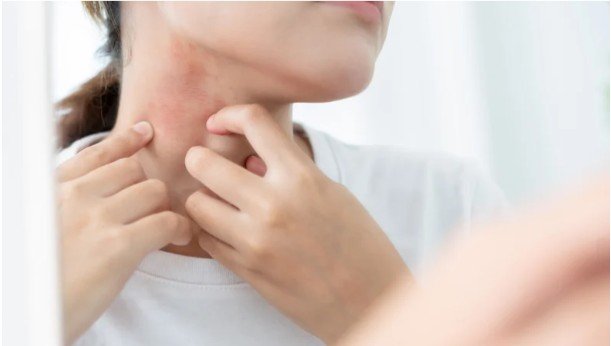 Flare-Up Prevention Tips