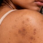 Body Care for Pigmentation and Dark Spots What Actually Helps Skin Fade Evenly